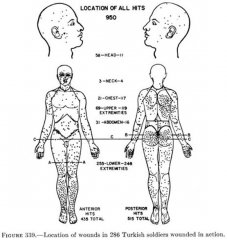 Wounds location